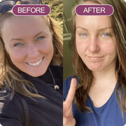 Dr. Melaxin Collagen Boost Set